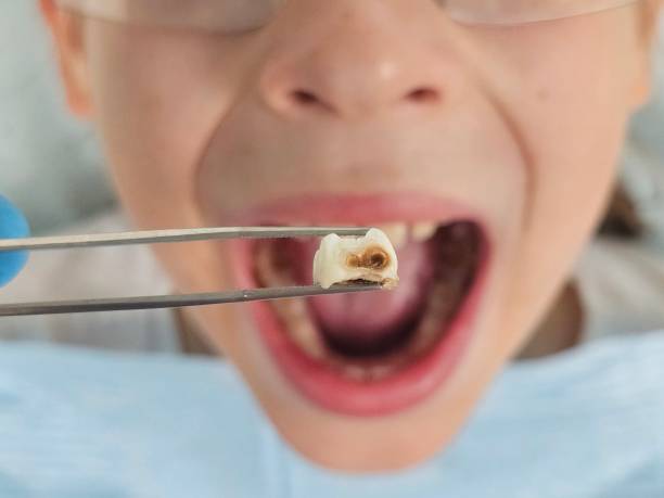 Best Pediatric Emergency Dentist in Great Notch, NJ